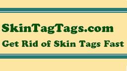 Skin tags